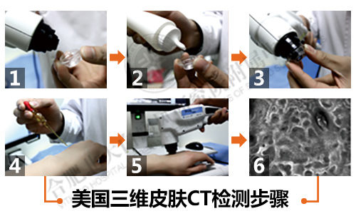 三維皮膚CT檢測(cè)系統(tǒng)